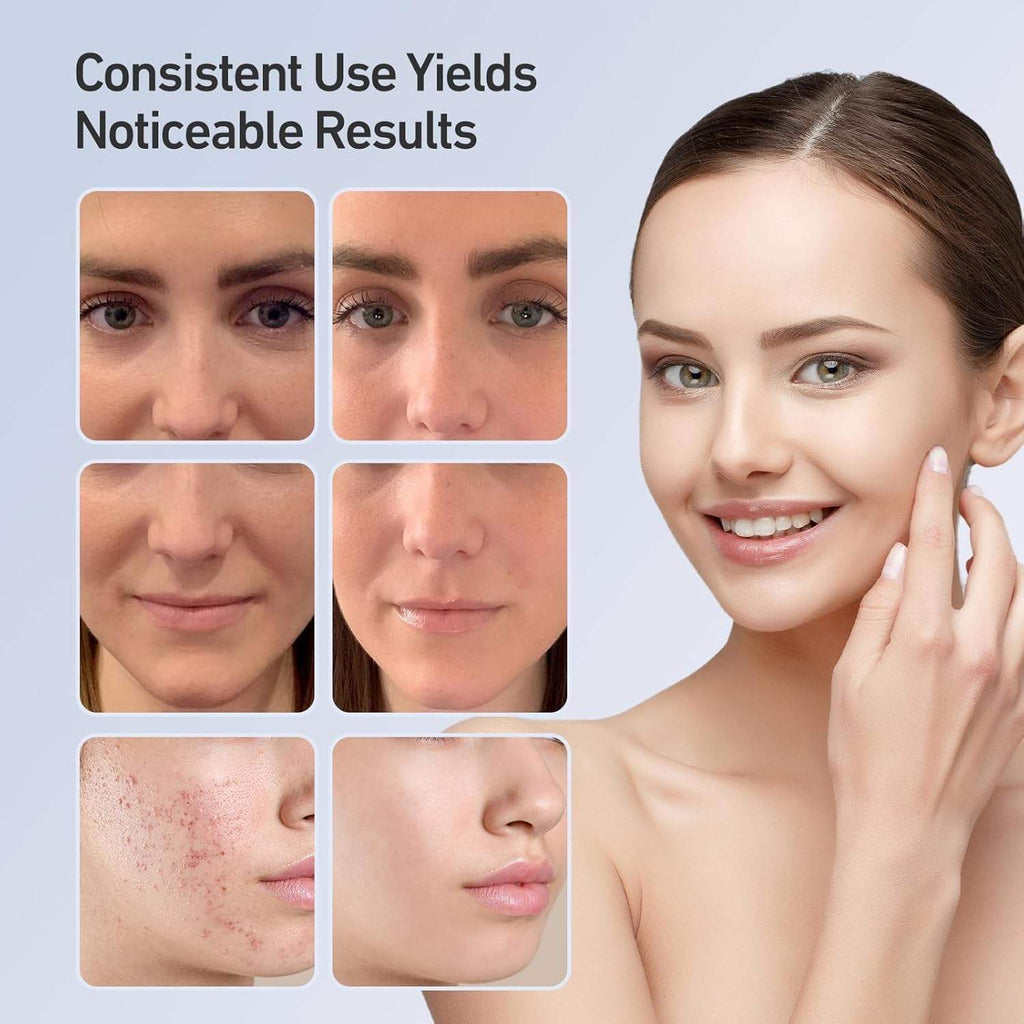 LED Light Therapy Facial Mask